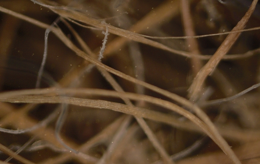 Immagini al microscopio della Posidonia